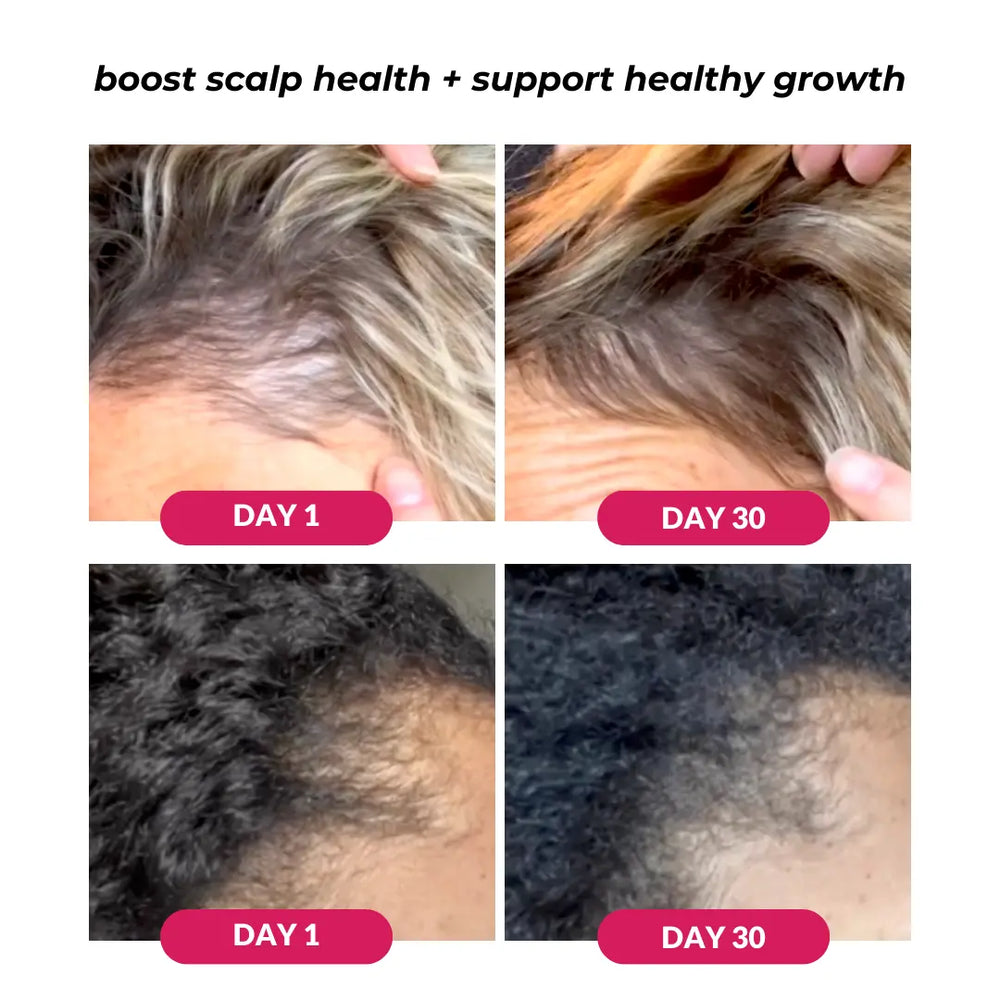 Which Scalp Serum Is Right For Your Hair?
